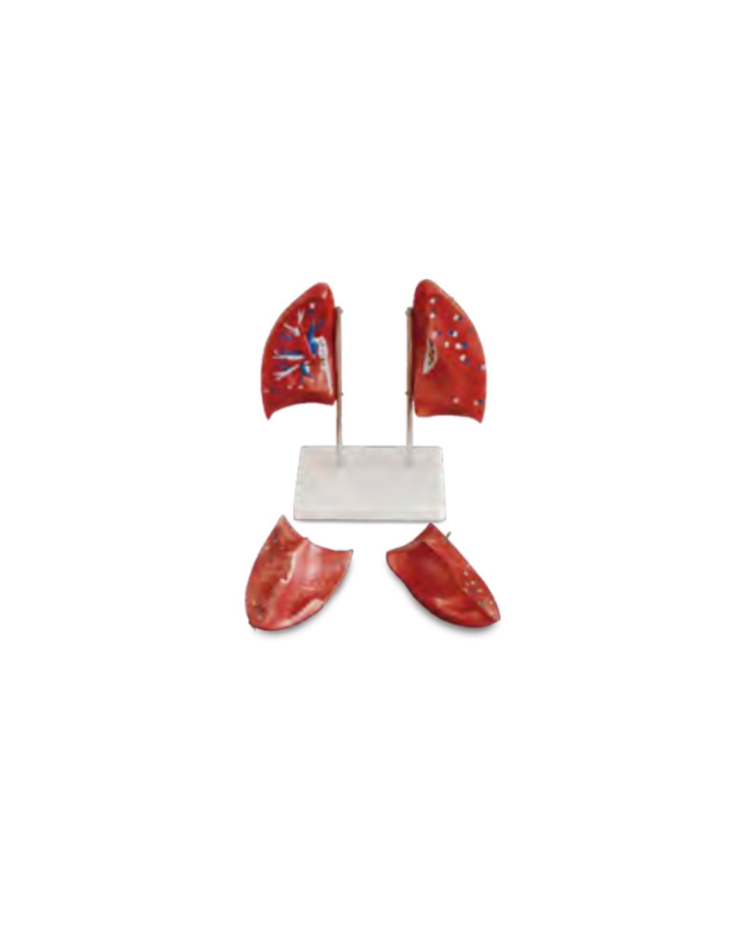 Pancreas, Spleen and Duodenum