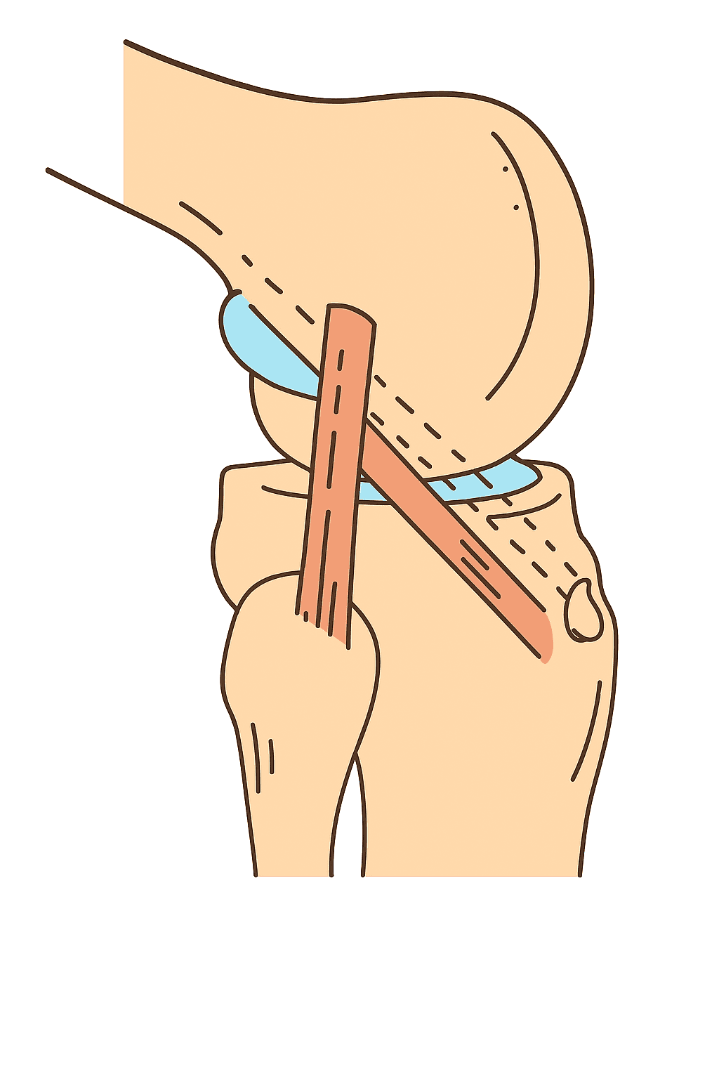 Cover image describing the article topic