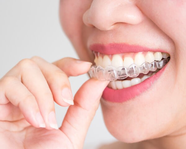 Orthodontic treatment with braces and invisalign clear aligners in Hong Kong