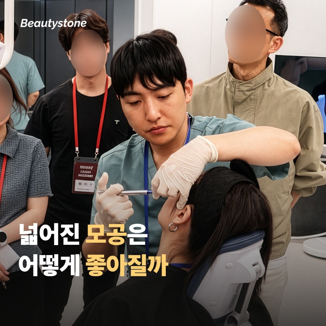 넓어진 모공 개선은 어떻게 기대하면 좋을까요