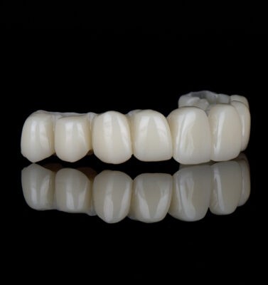 Digital Treatment Planning