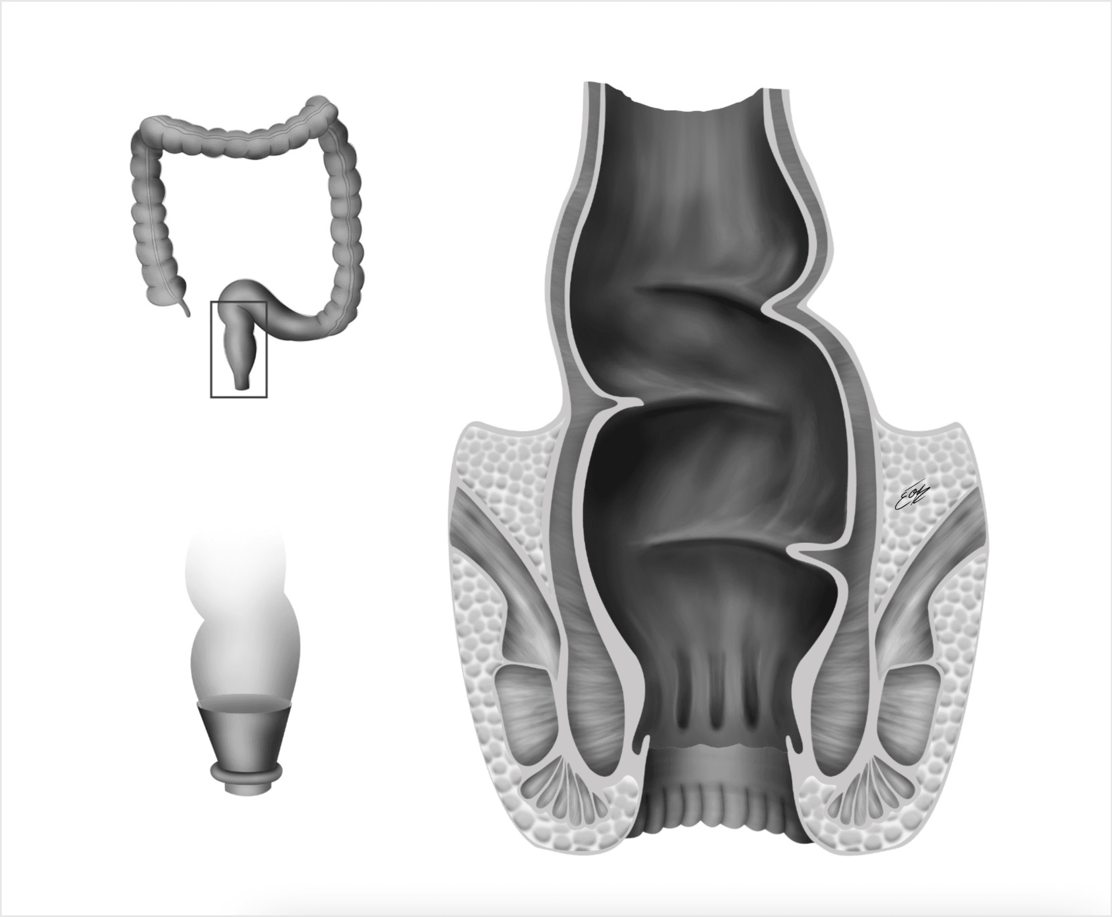Illustration scientifique l'anatomie du rectum/canal anal/ anus en noir et blanc par l'illustratrice scientifique Élodie Ouellet-Belleau.