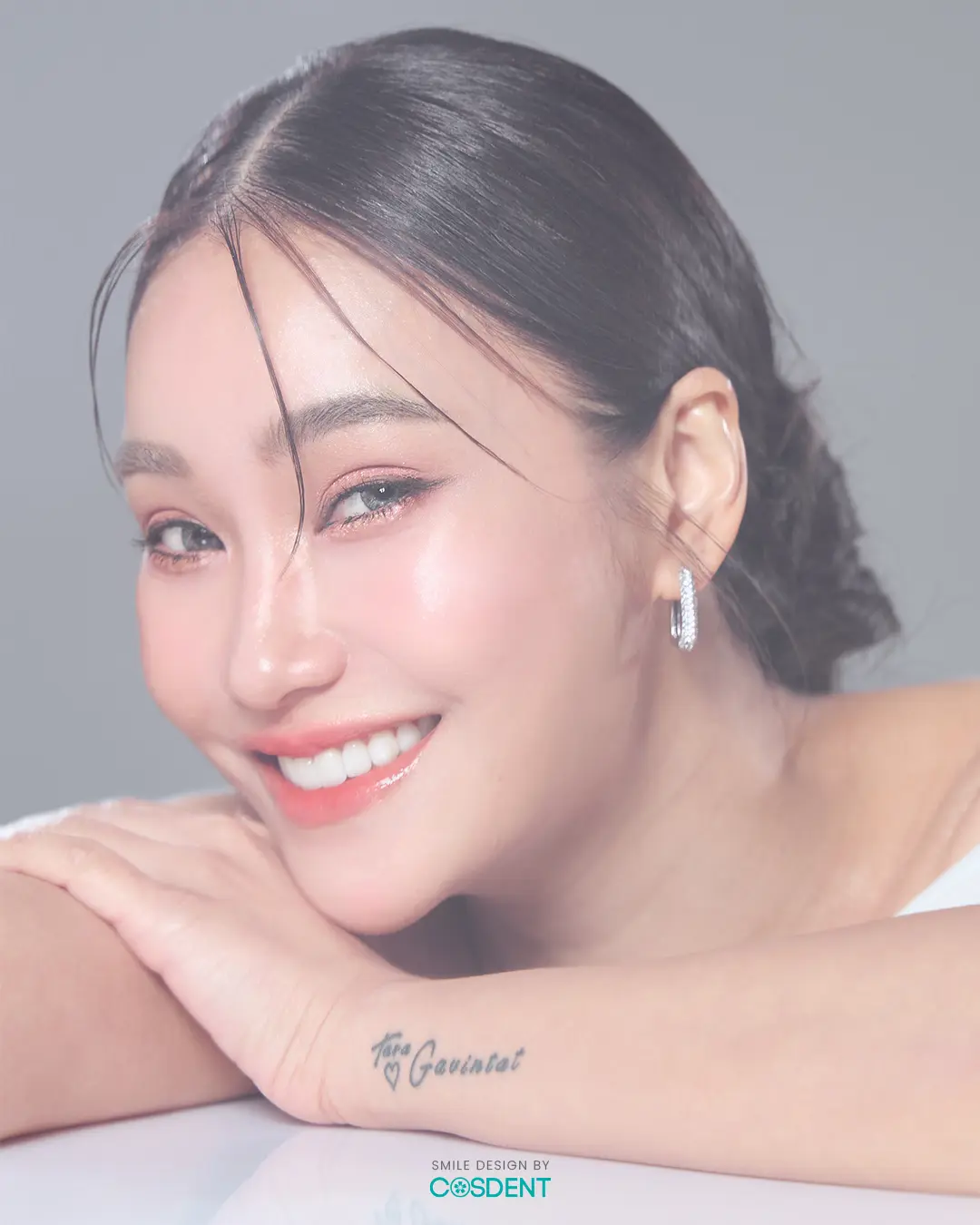 คุณชมพู่ เคสทำวีเนียร์ หมอวรรณ cosdent smile design