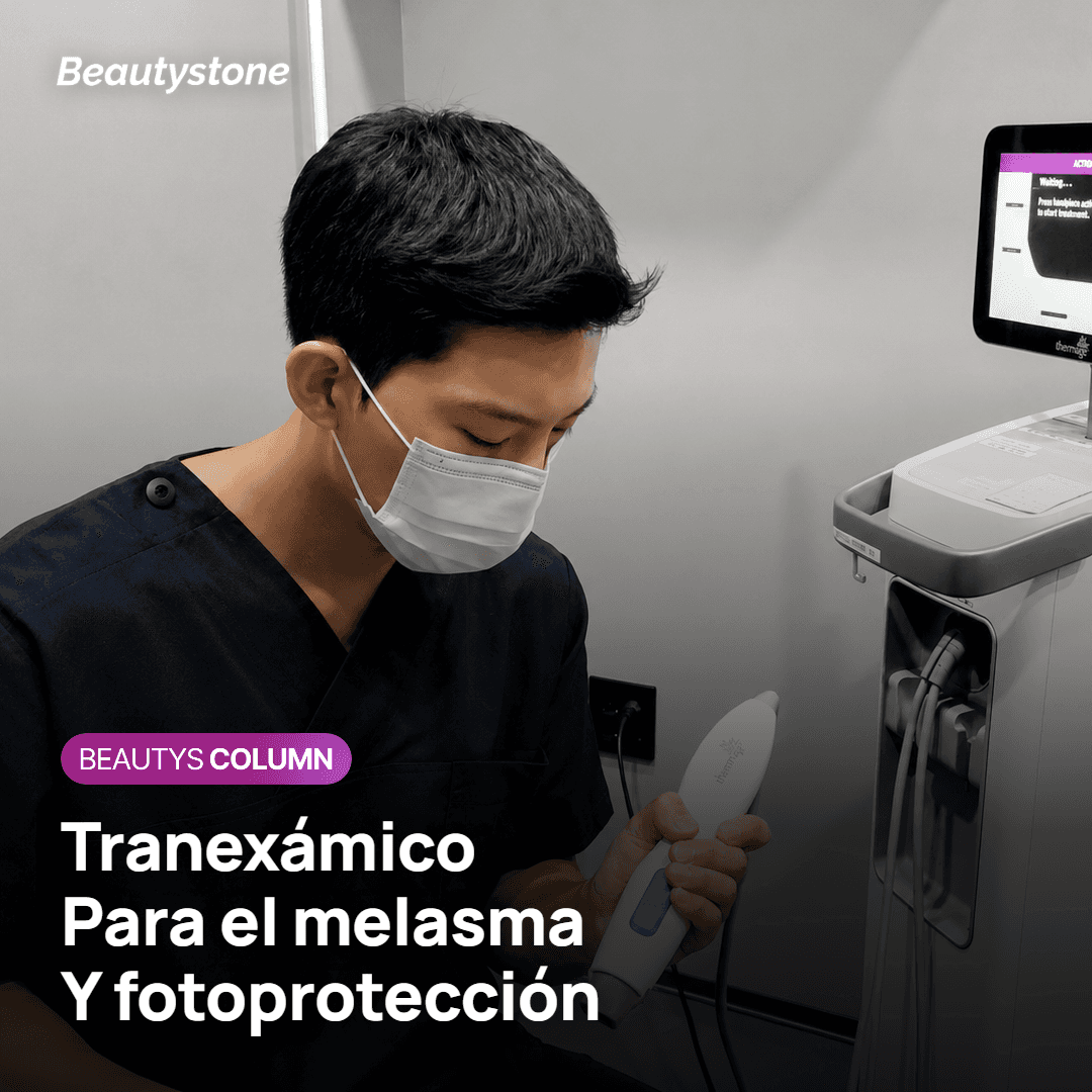 El ácido tranexámico actúa sobre el estímulo crónico del melasma