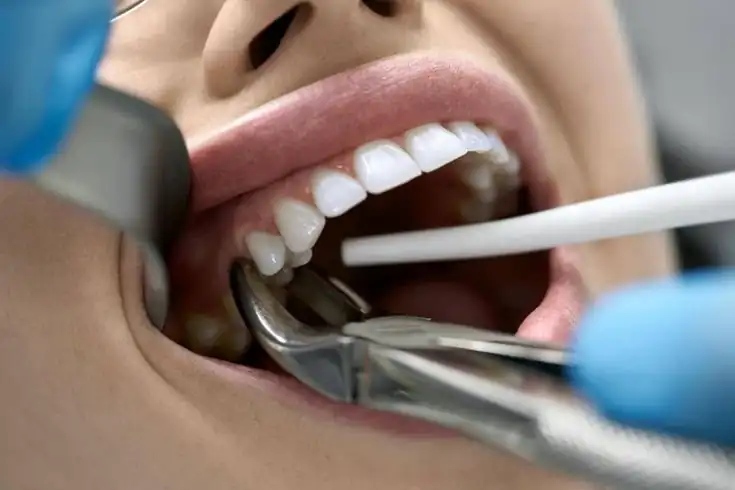 A smiling dentist in a white coat holding a clear dental aligner
