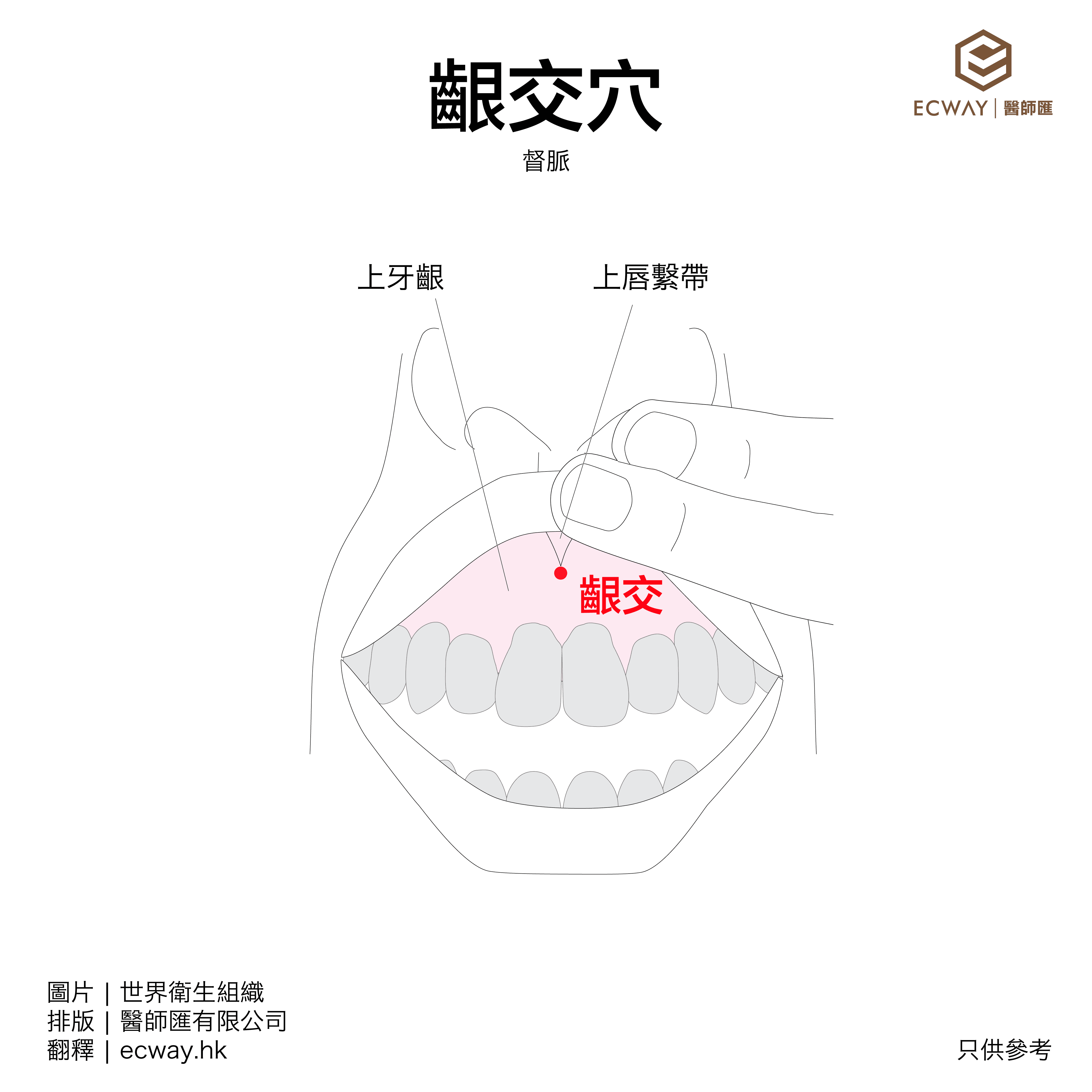 齦交穴