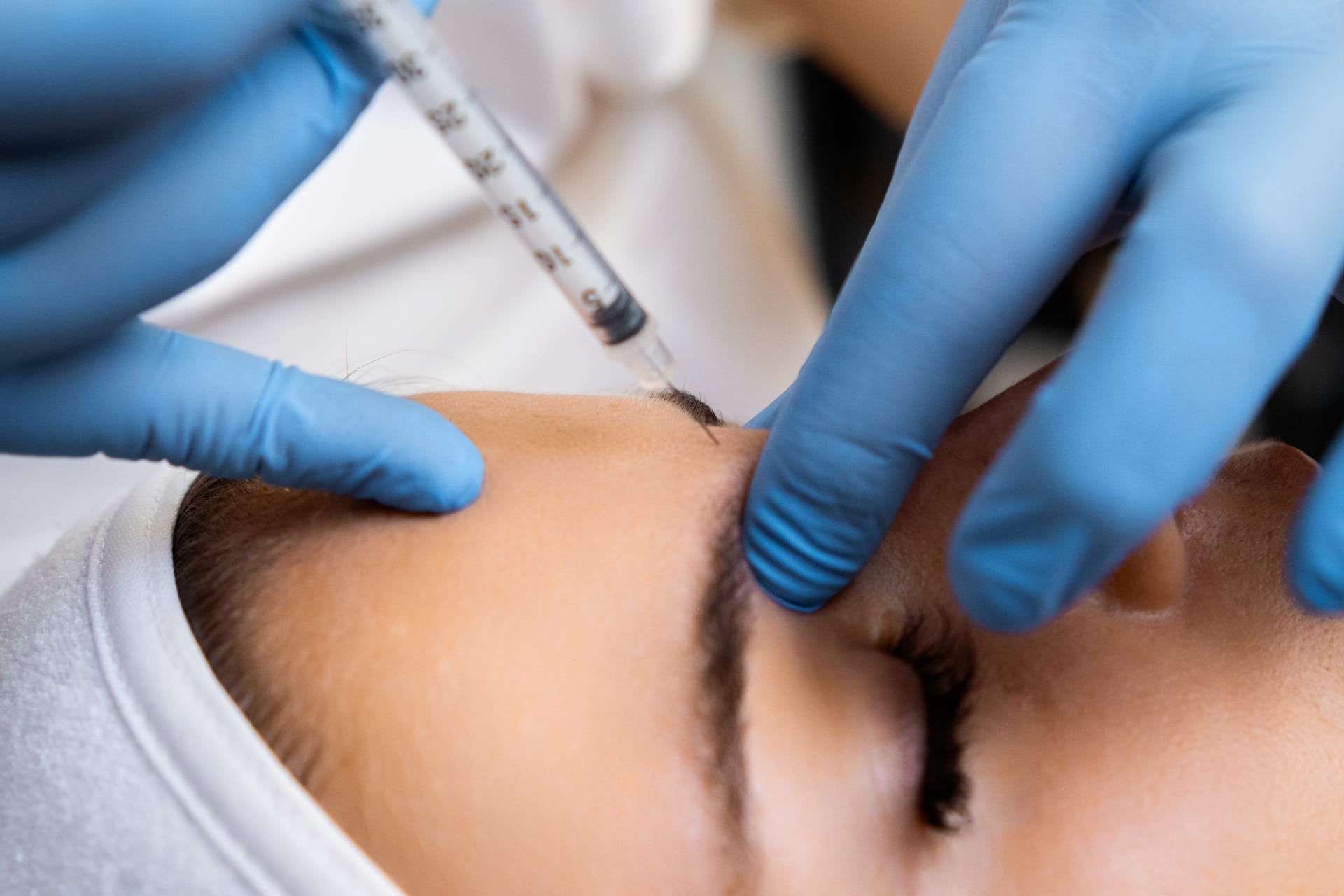 Close-up of a Botox injection being administered near the glabella - precision neurotoxin treatment at Avinity Health near Gainey Ranch, Scottsdale.