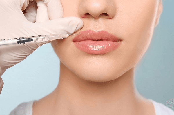 Tiêm filler môi là phương pháp giúp tạo dáng môi trên mỏng, môi dưới dày một cách tự nhiên