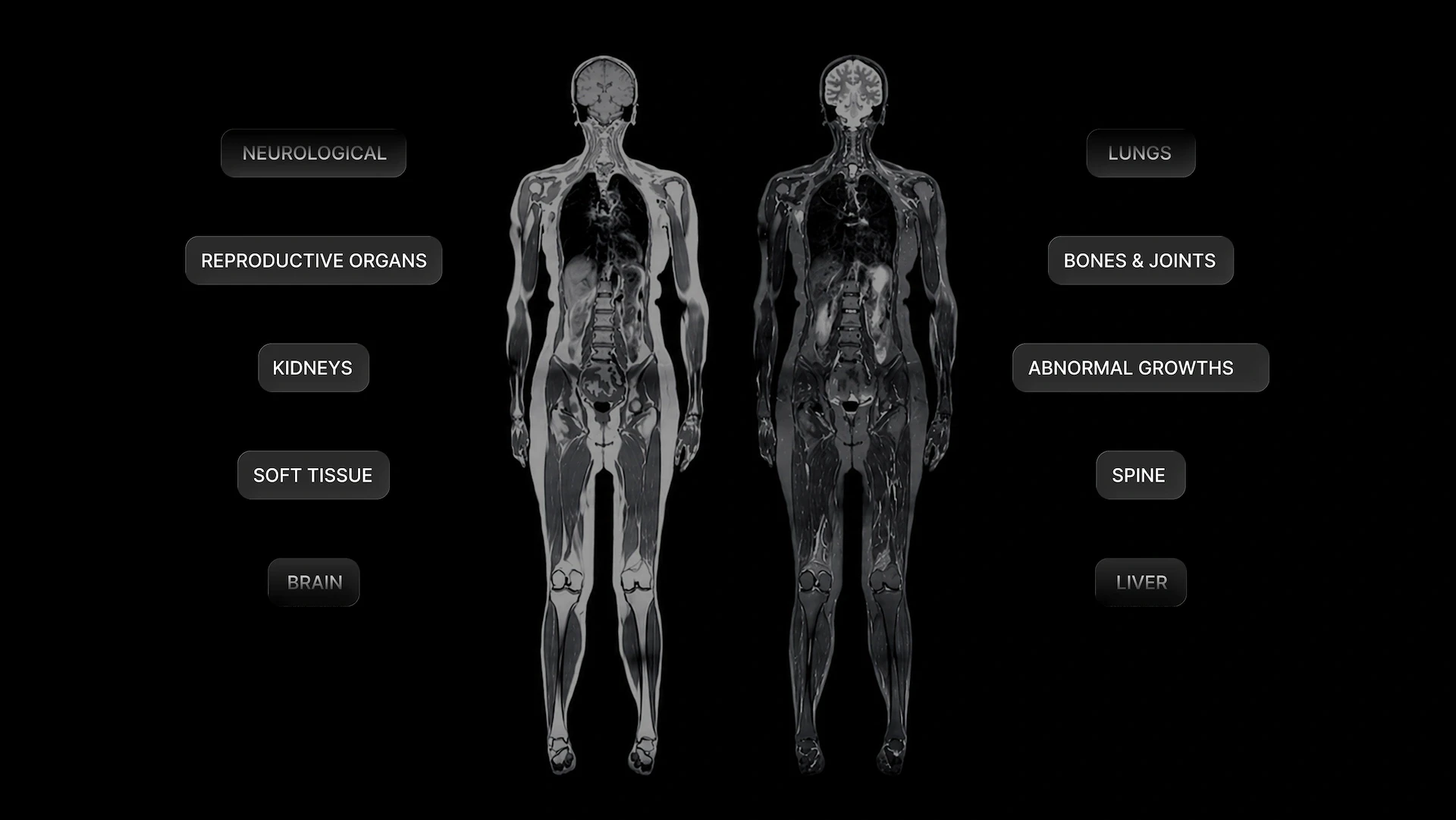 Full body mri scan with advantages listed