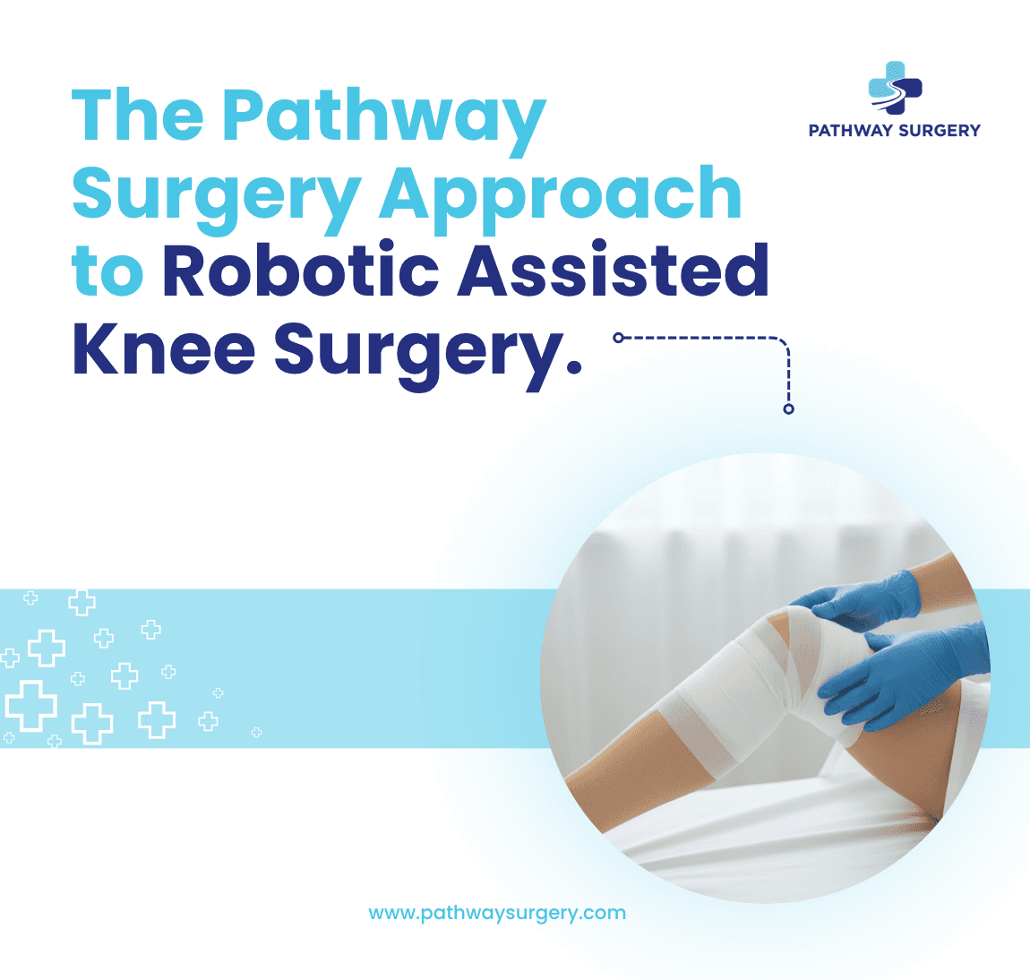 The Pathway Surgery Approach to Robotic Assisted Knee Surgery