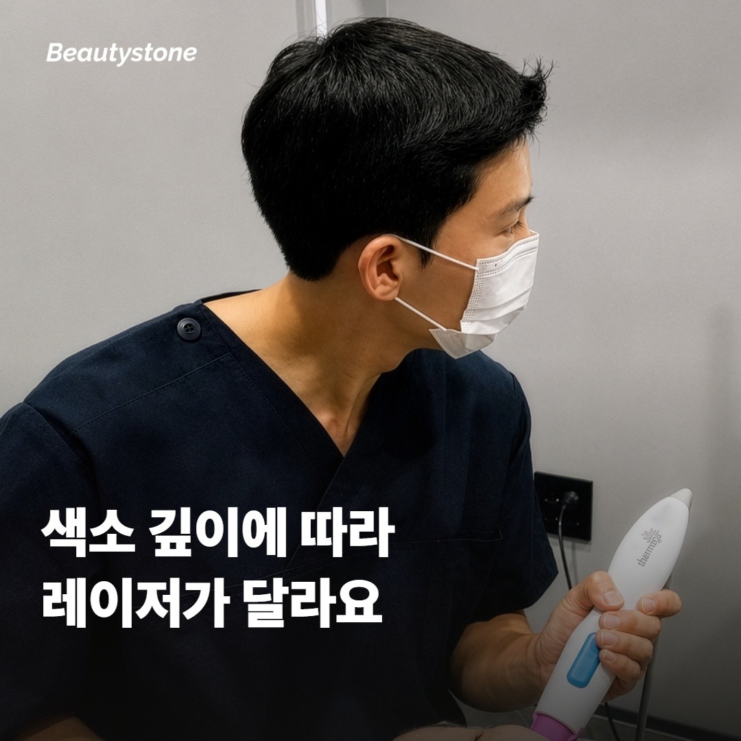 색소 깊이에 따라 레이저가 달라지는 이유