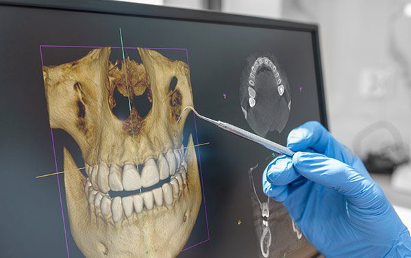 Teeth Checkup