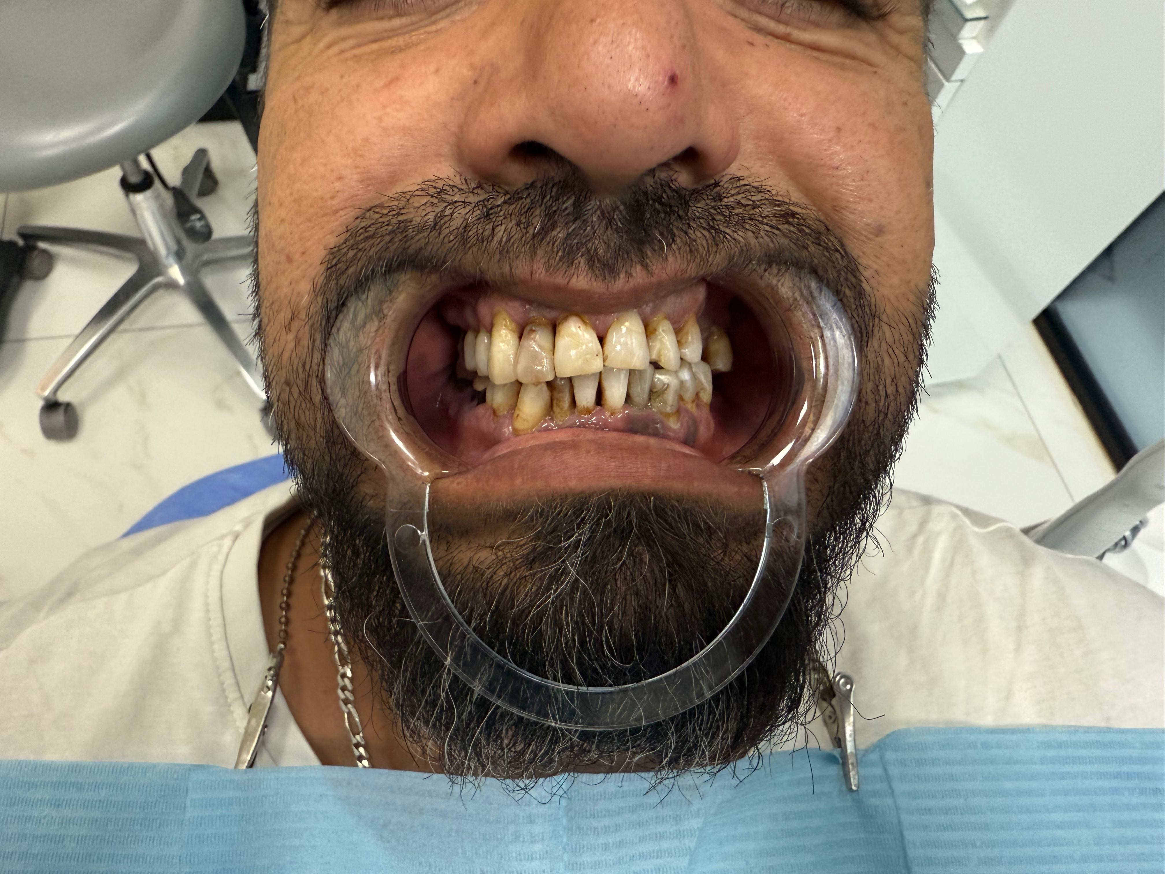 Before Image