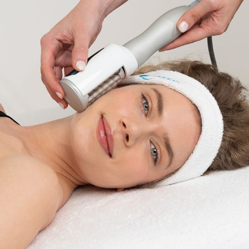 Laser Skin Rejuvenation Being Performed