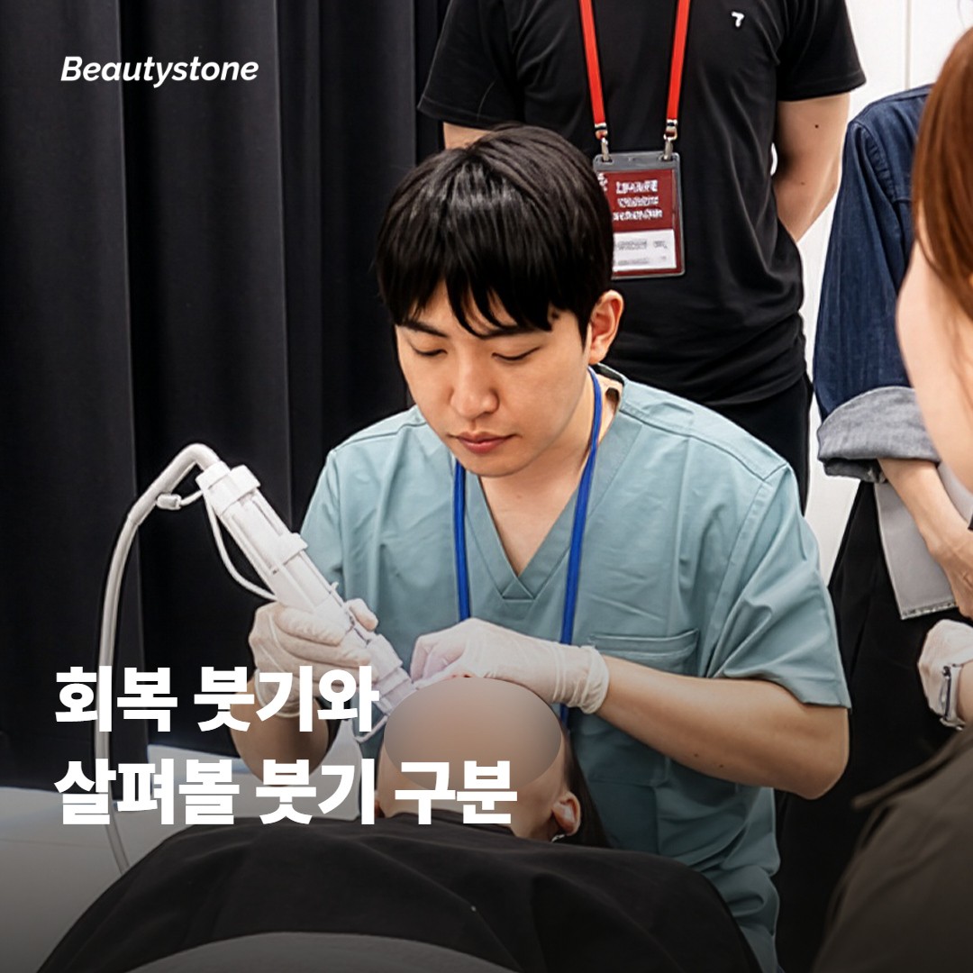 아침 붓기와 오래 지속되는 붓기는 어떻게 다를까요