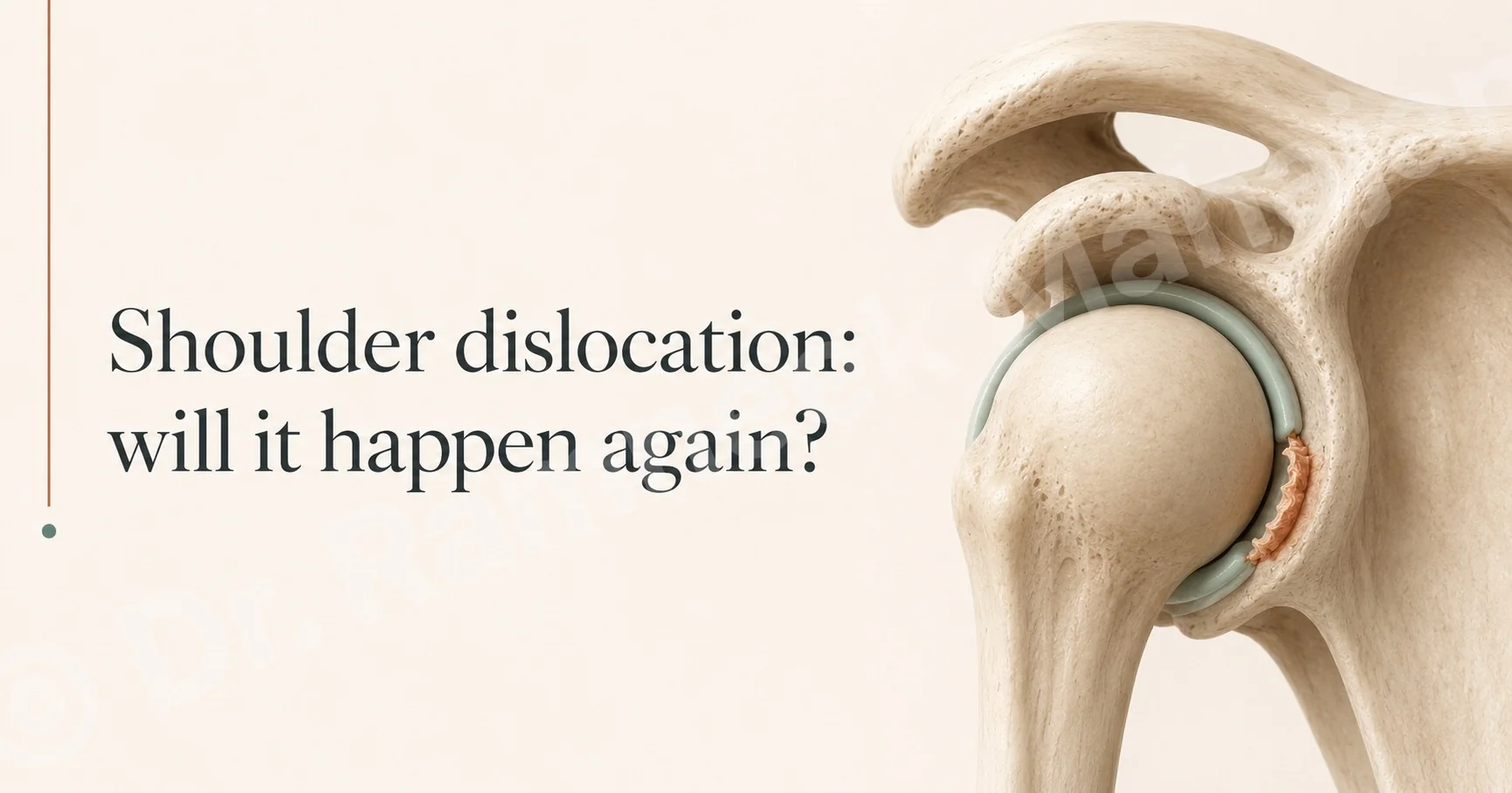 Dr Ramneek Mahajan's guide to shoulder dislocation: whether it happens again and when surgery helps.