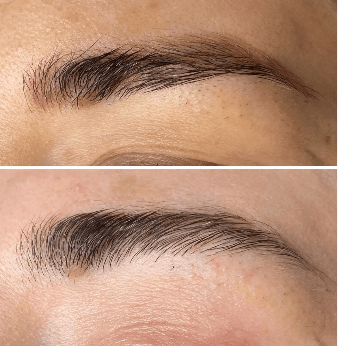 PMU & Microblading entfernen