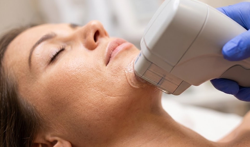 HIFU-lifting bij Skin Boost Clinic in Rijswijk