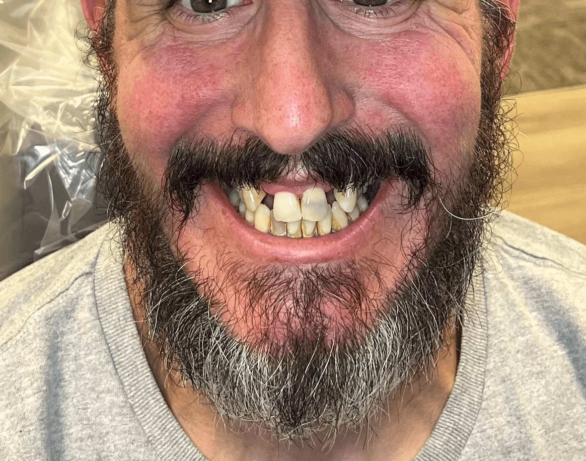Case 01 before treatment photograph