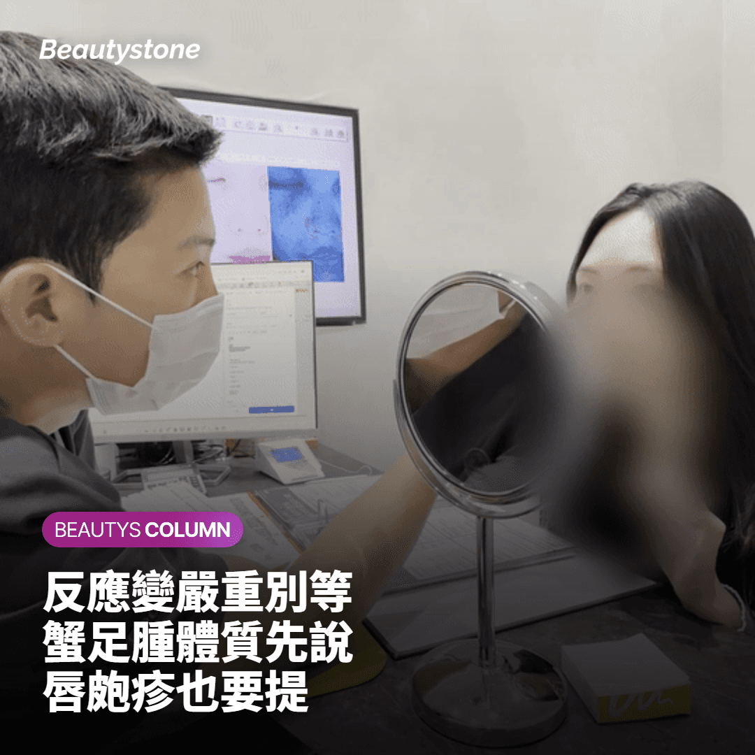 哪些反應不該只是等？哪些人做之前要先說