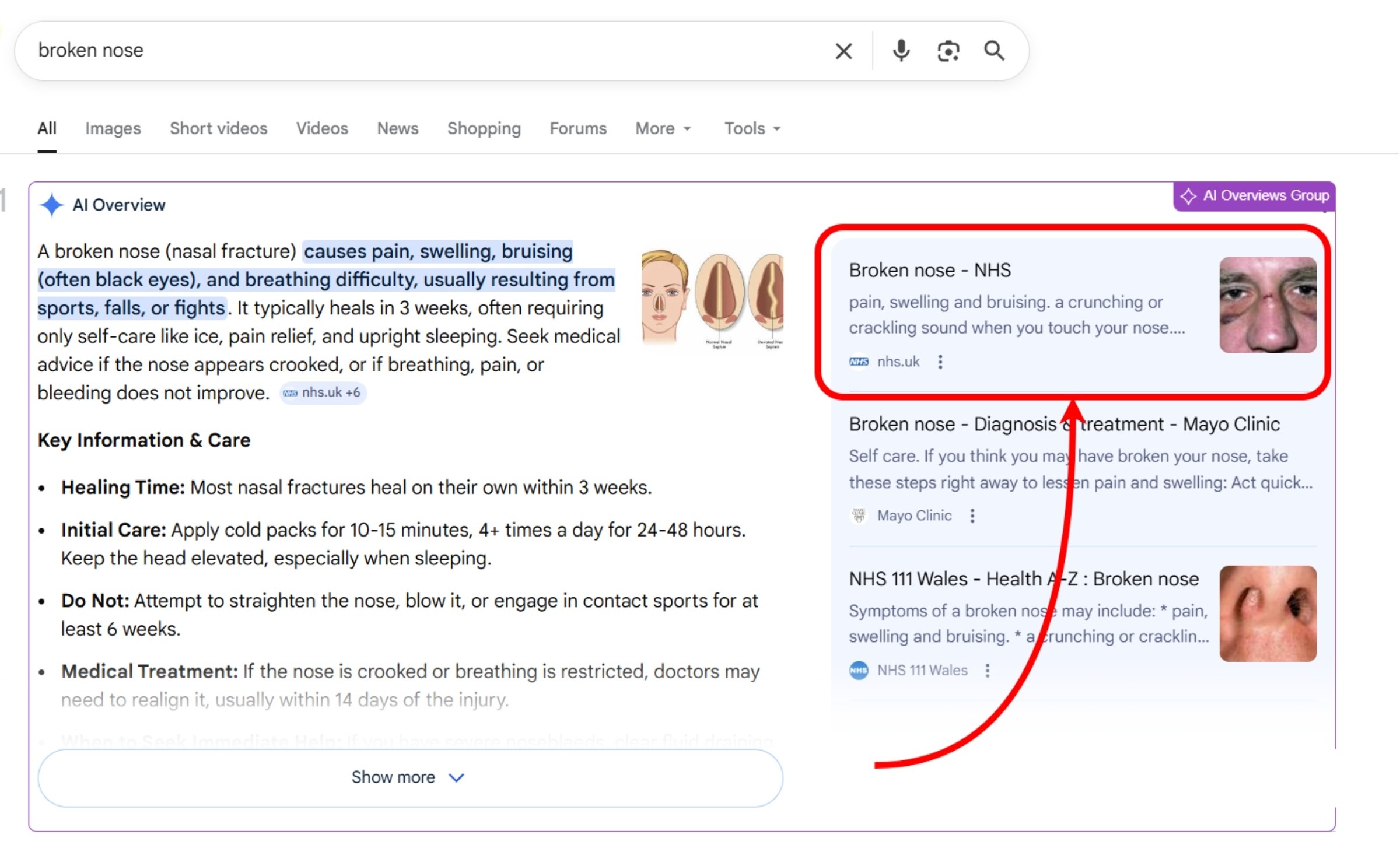 how-to-see-if-you-are-a-top-aio-source-in-serp