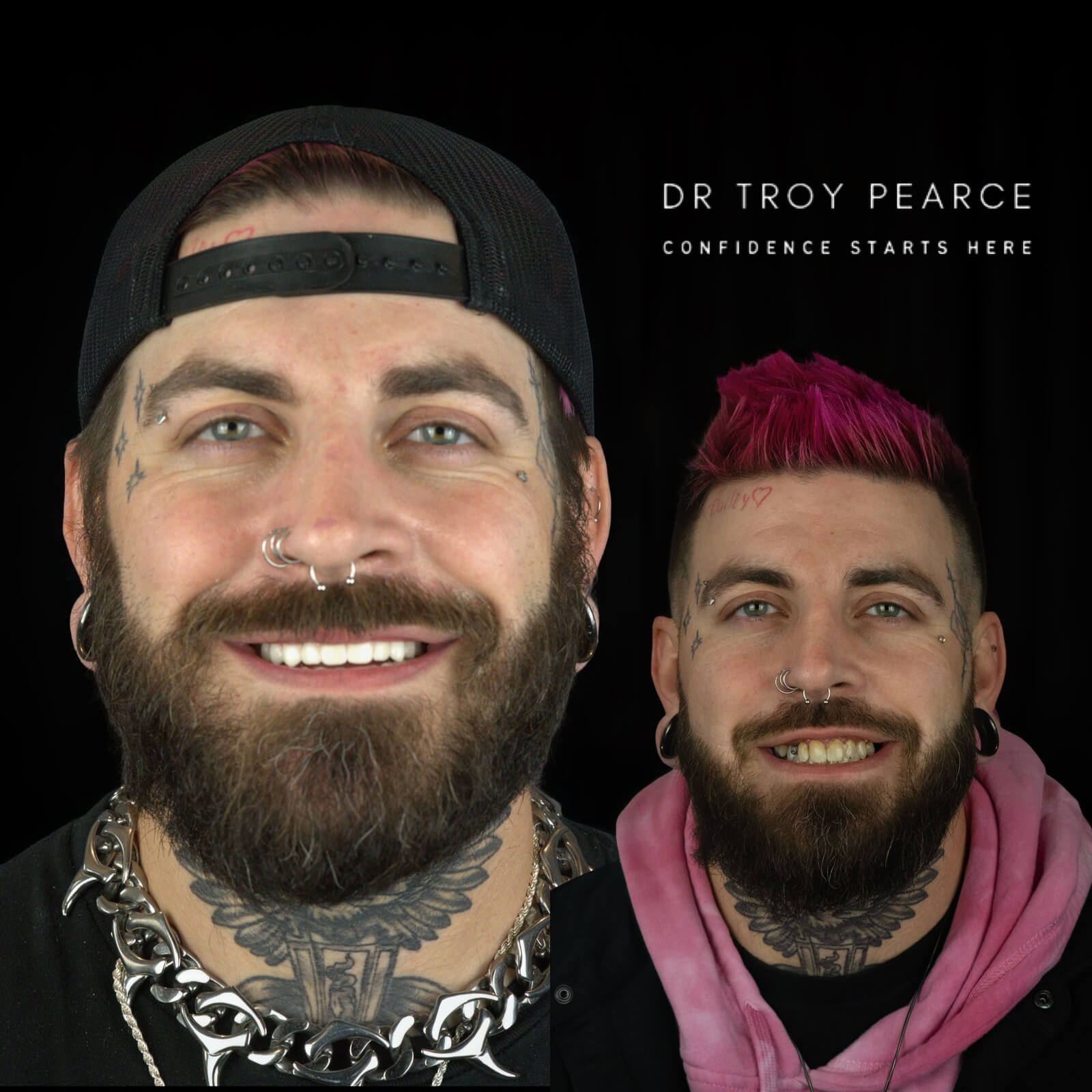 patient after before