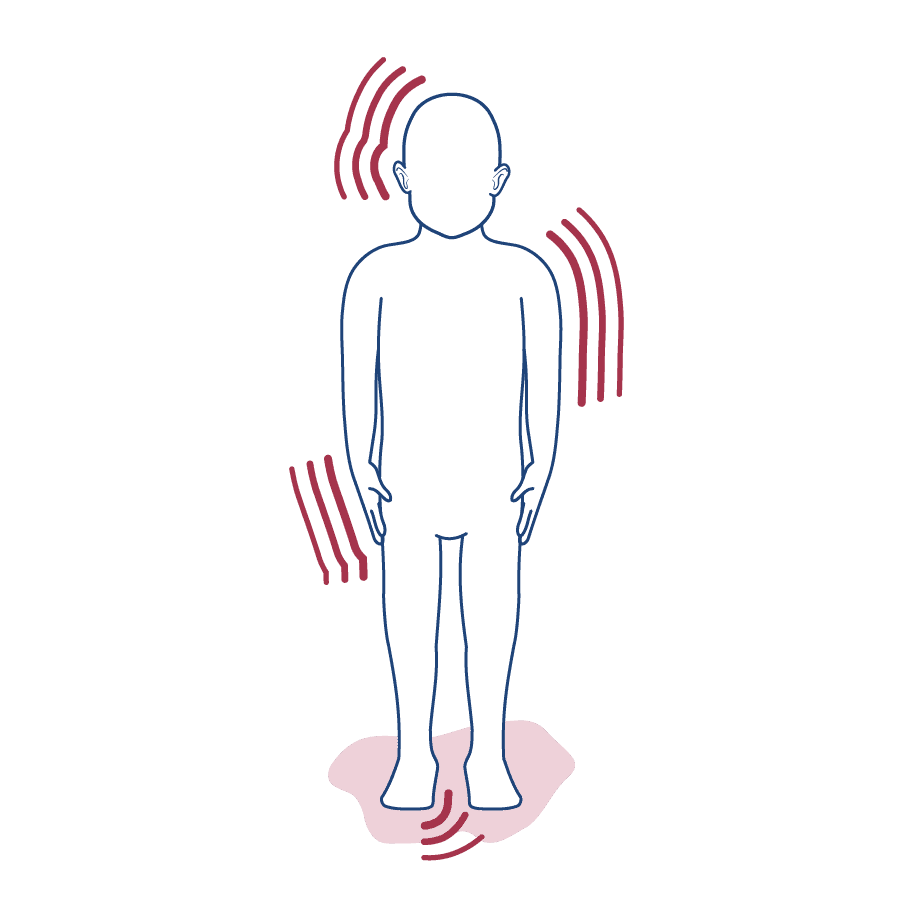 Ilustração de um homem de costas, com a parte da coluna sinalizada, representando a dor na região.