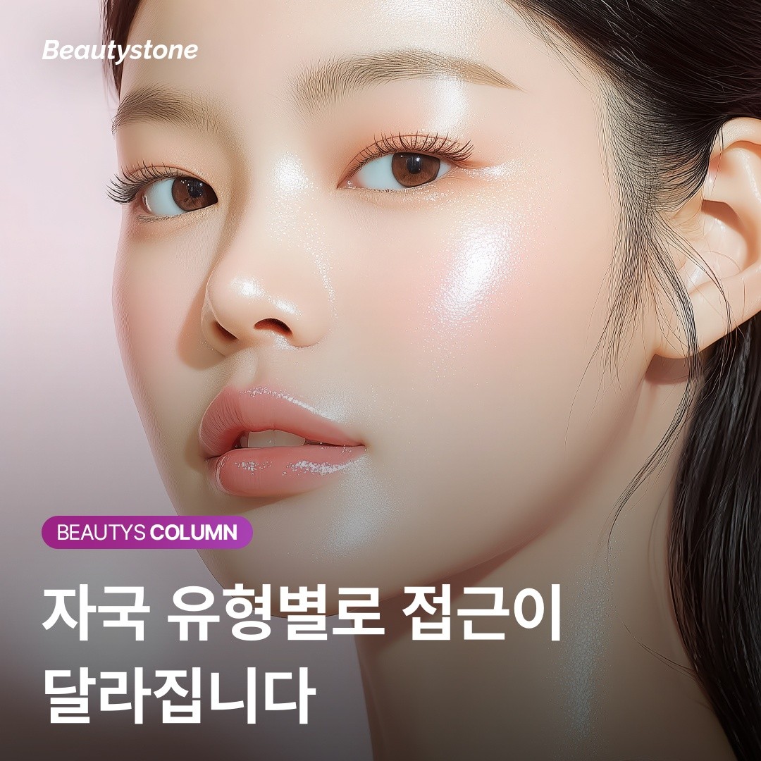 여드름 빨간자국의 해답은 혈관에 있습니다: 원인을 알면 치료가 빨라집니다