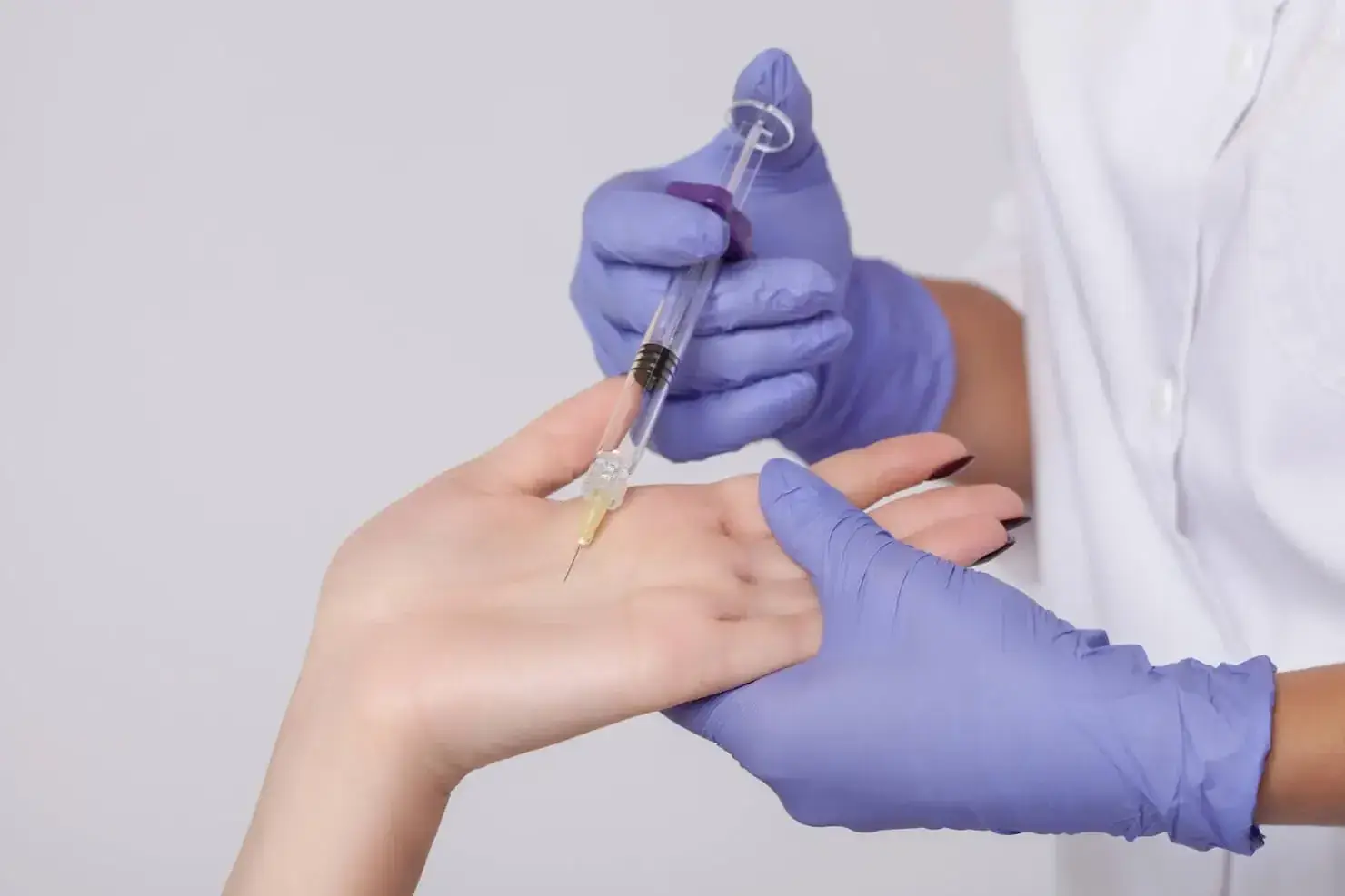 Patient receiving Botox injections for underarm hyperhidrosis to effectively reduce excessive sweating and improve daily comfort.
