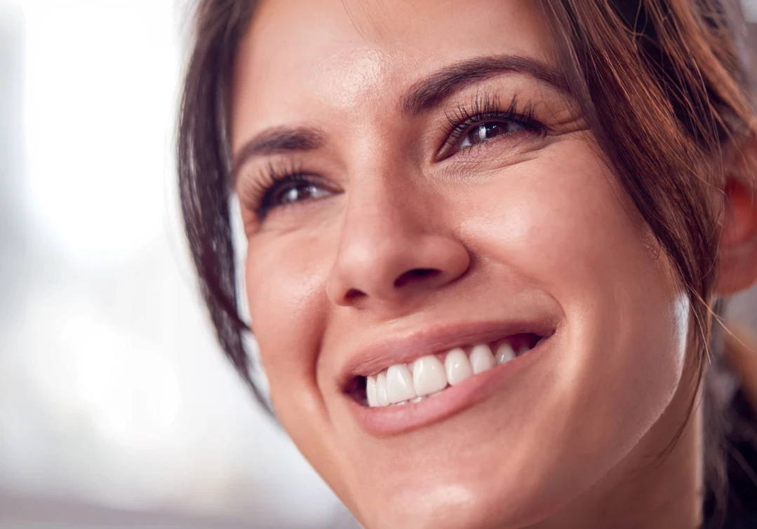 Kobieta z uśmiechem prezentująca efekty bondingu na swoich zębach.