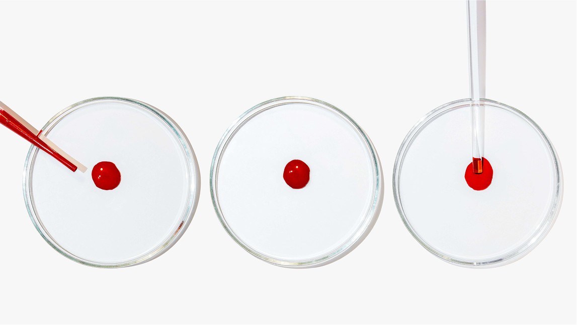 Blood Tests in Cancer Diagnosis and Monitoring