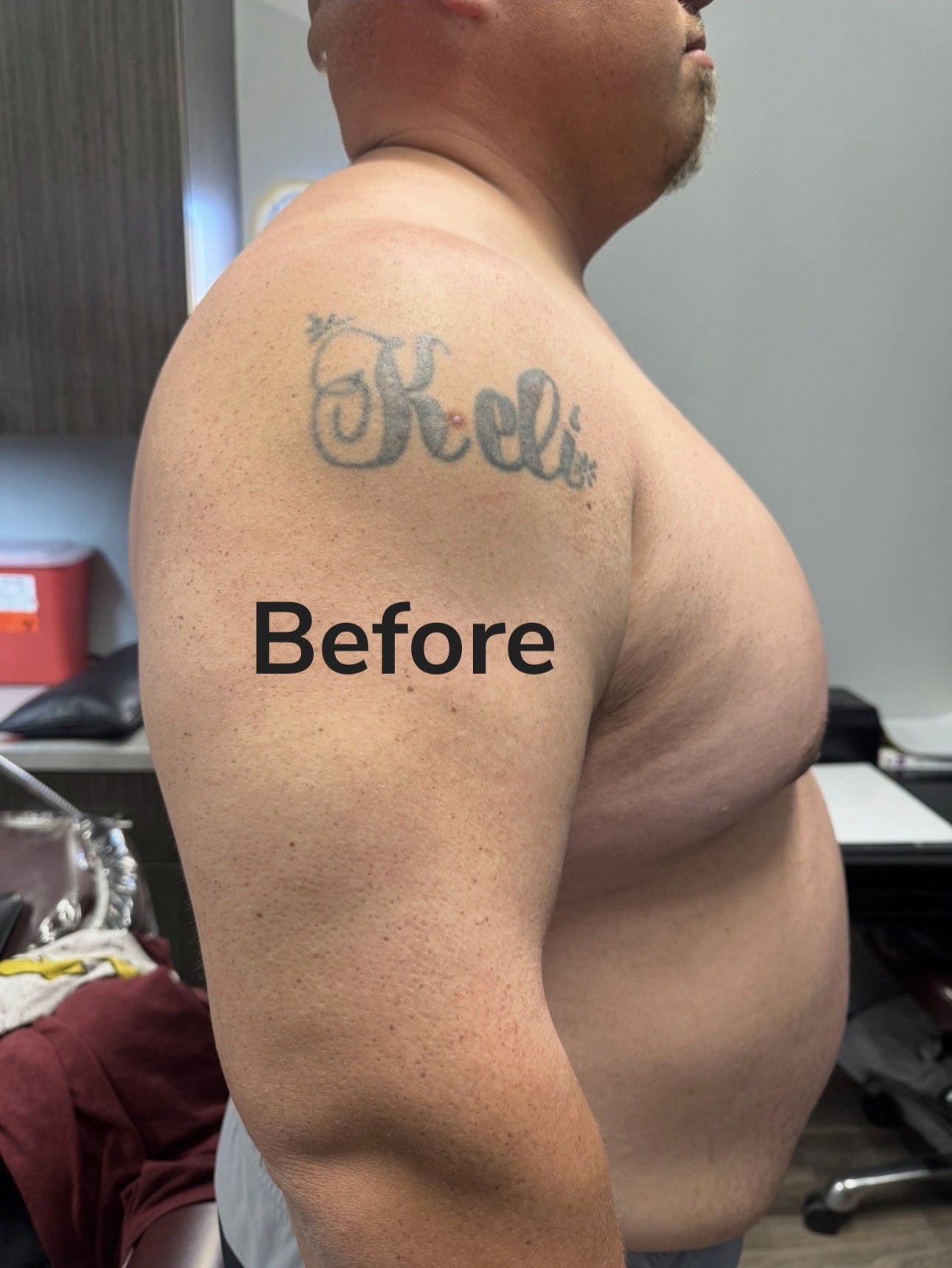 Before: the original tattoo on the shoulder before the Flag Cover-Up Sleeve by Meer Rich
