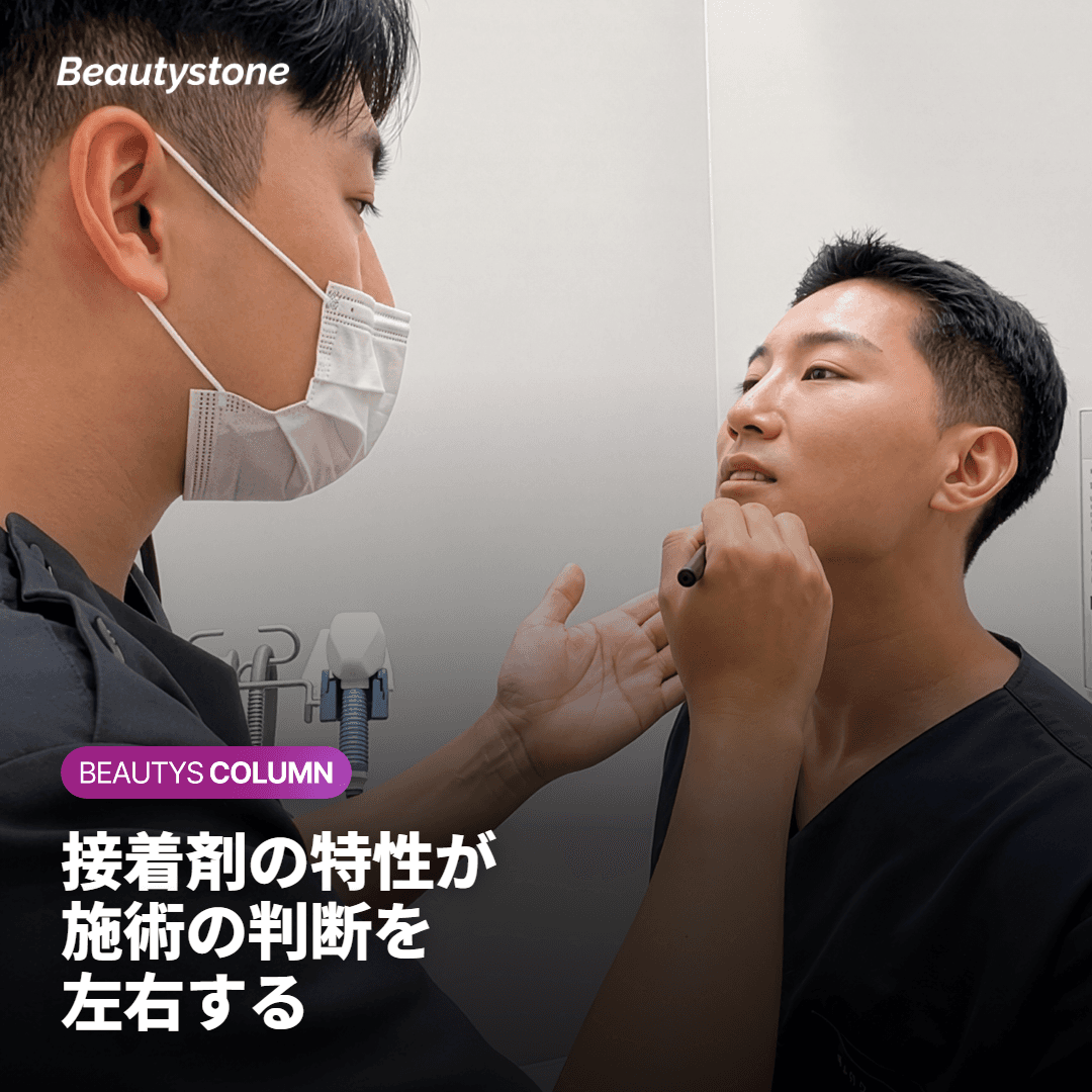 まつエクの接着剤と眼の保護レンズの関係を示した教育用断面図