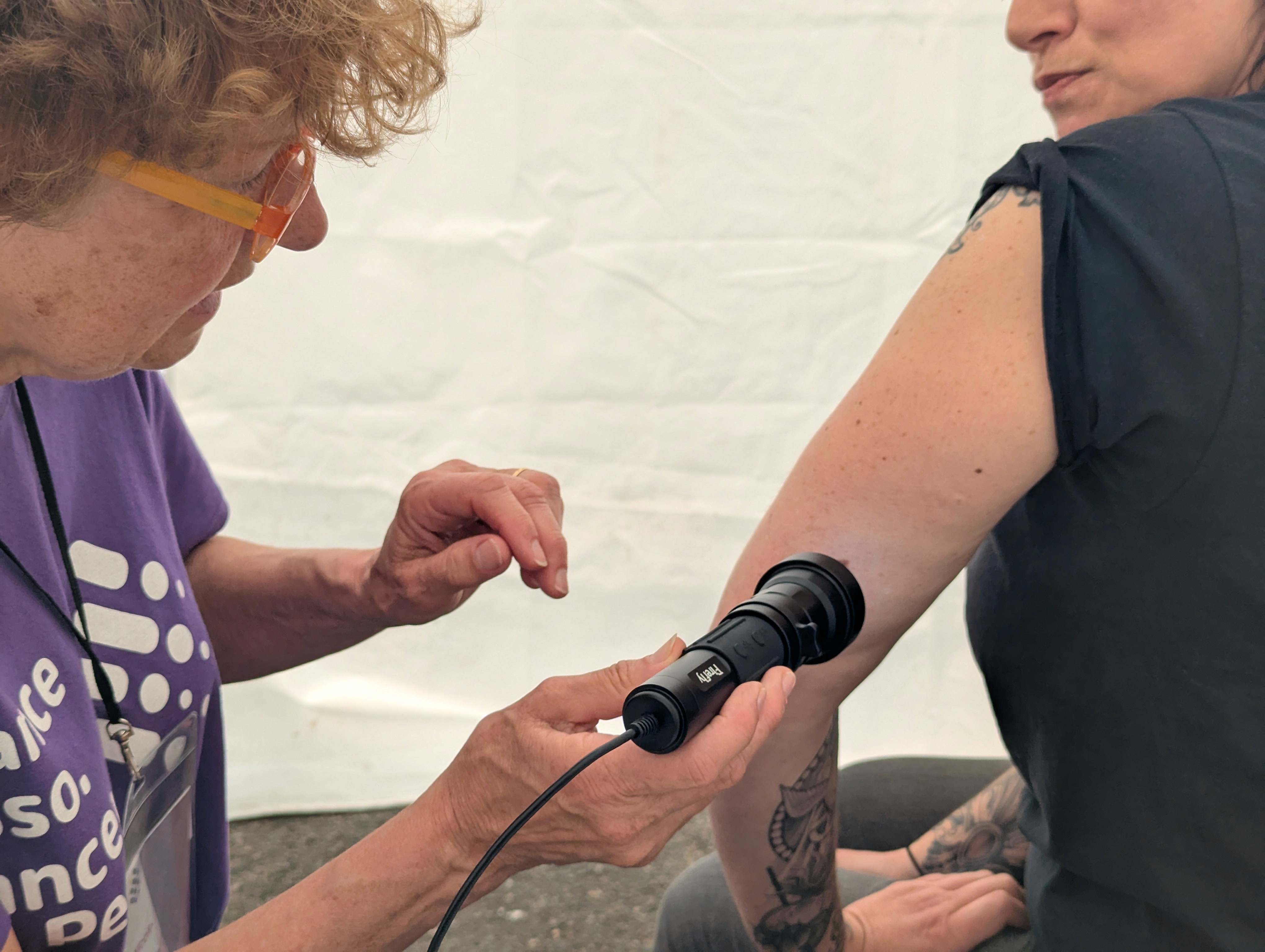 Dermatoscope utilisé sur une lésion
