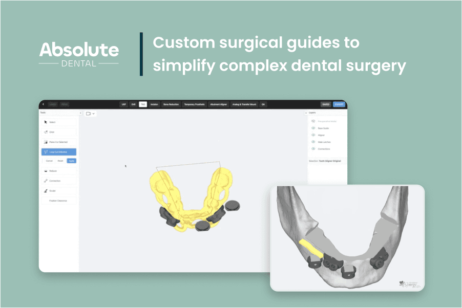 Building's facade with many windows and shadows.
