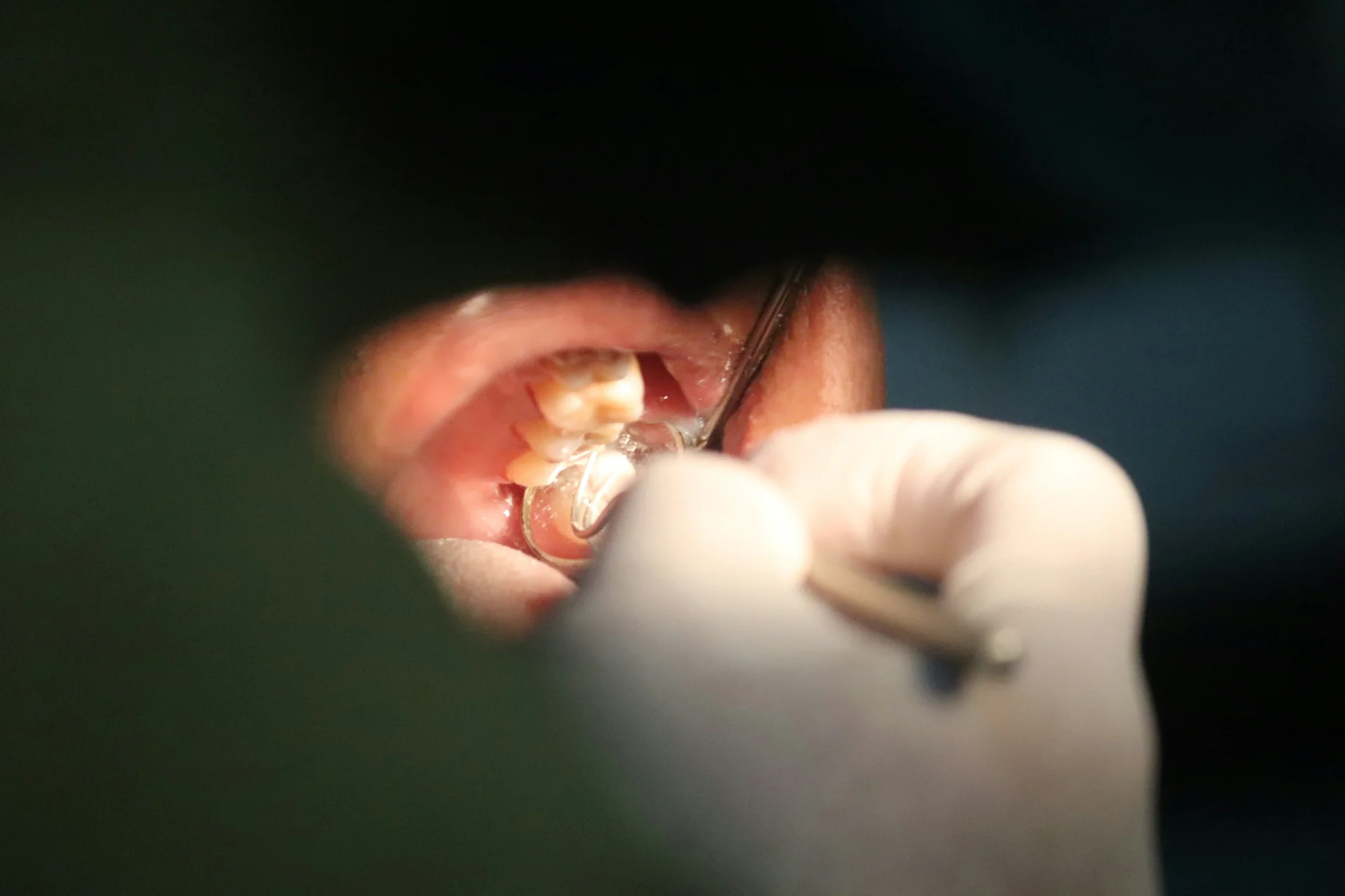 Oral Surgery service image