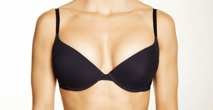 Breast Lift