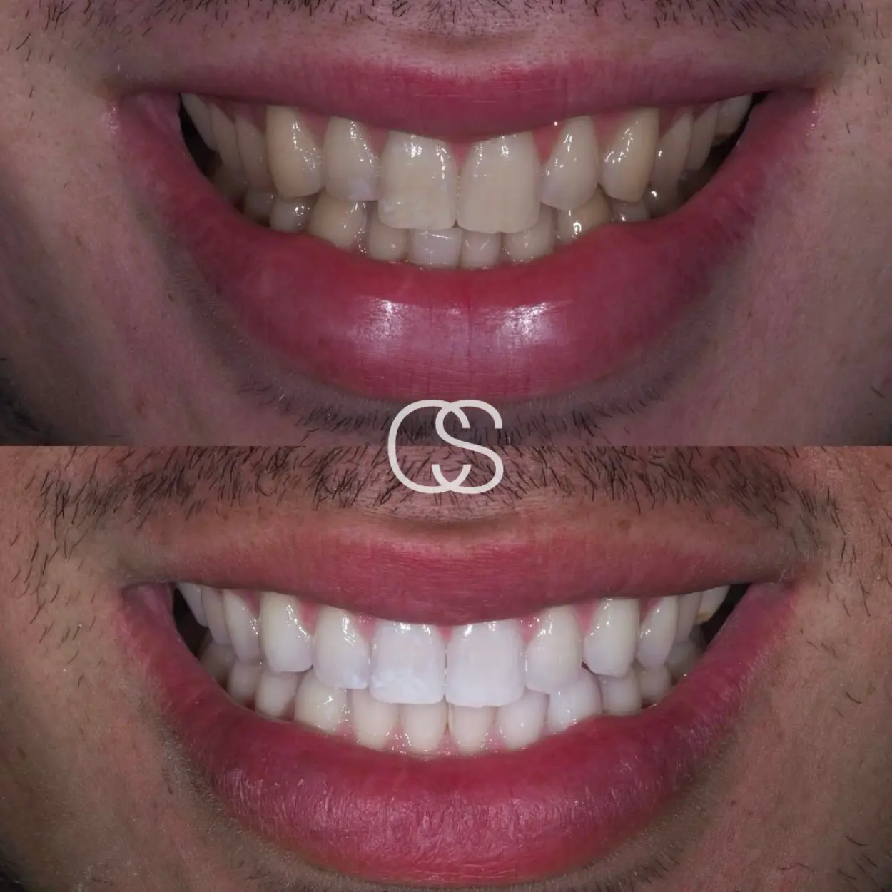 Dental whitening Colac