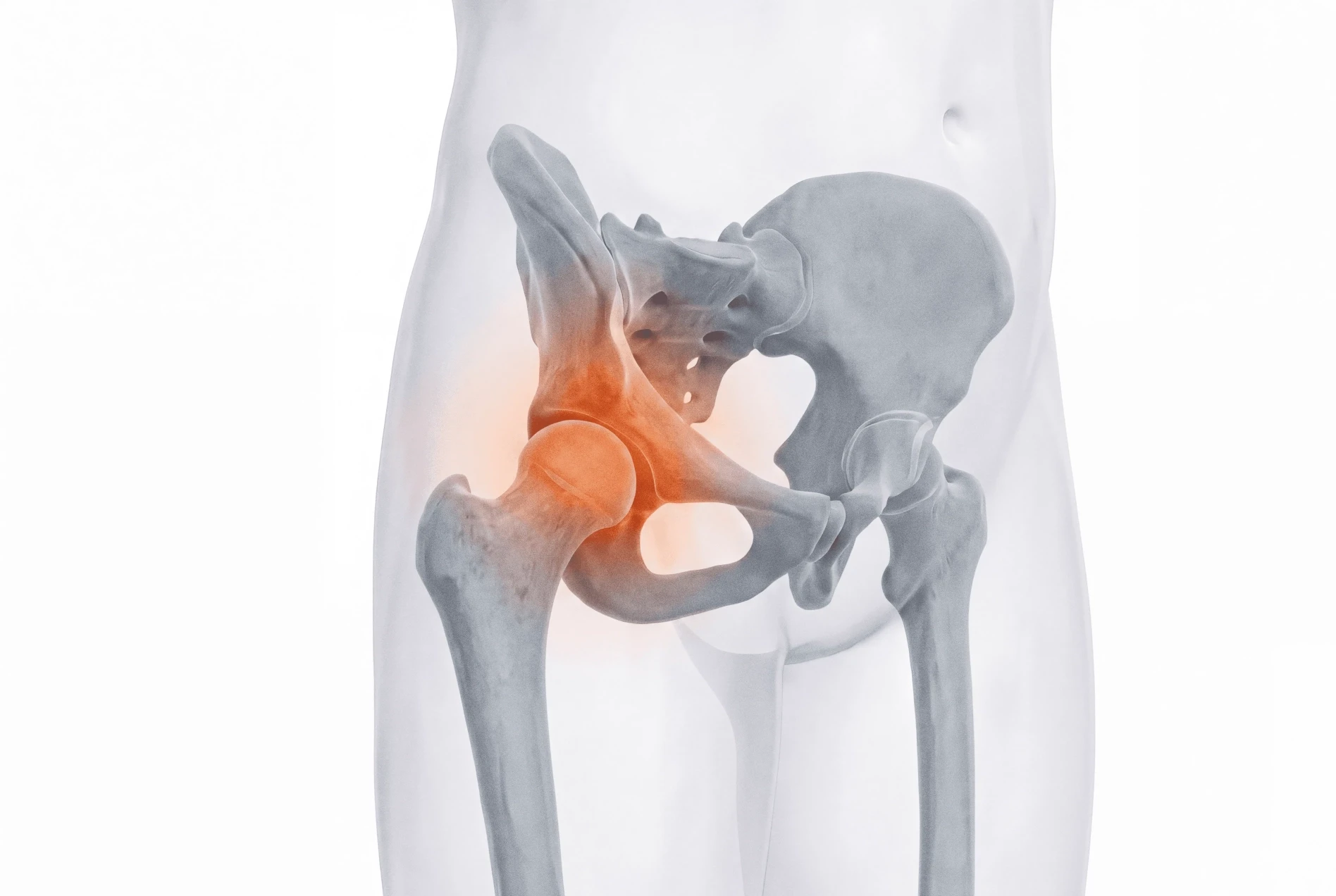 Child Transient Synovitis