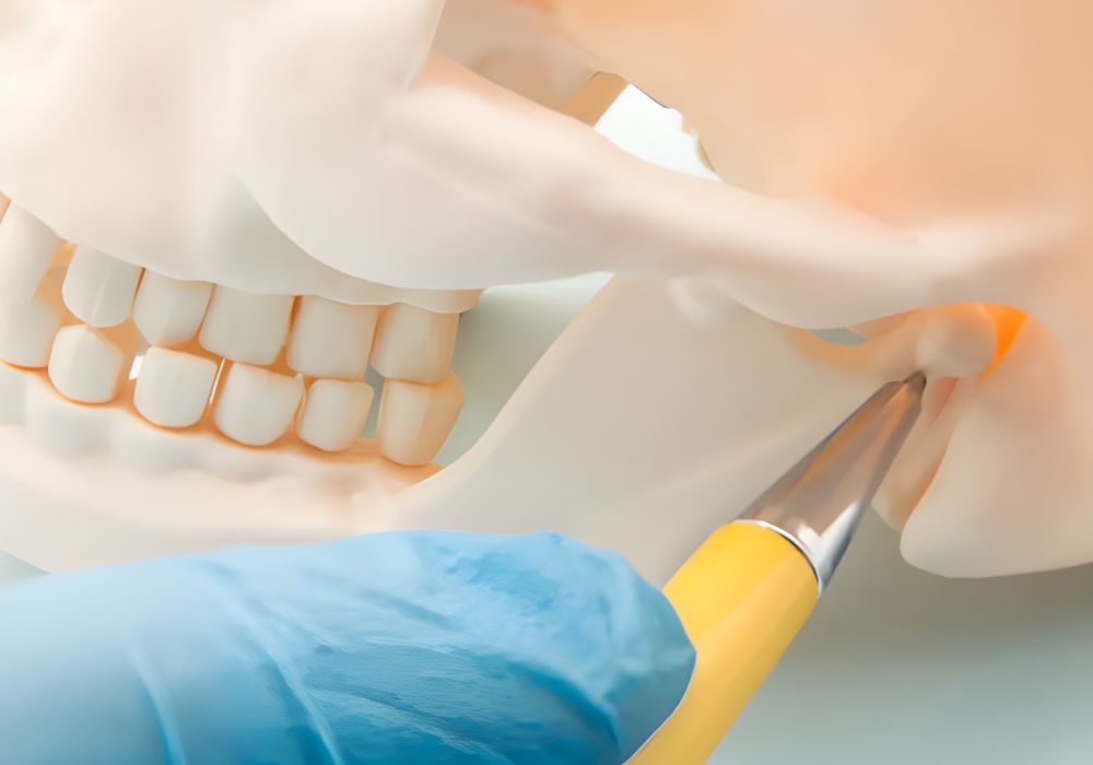 Dental model illustrating the jaw joint area (TMJ) with highlighted pain point.