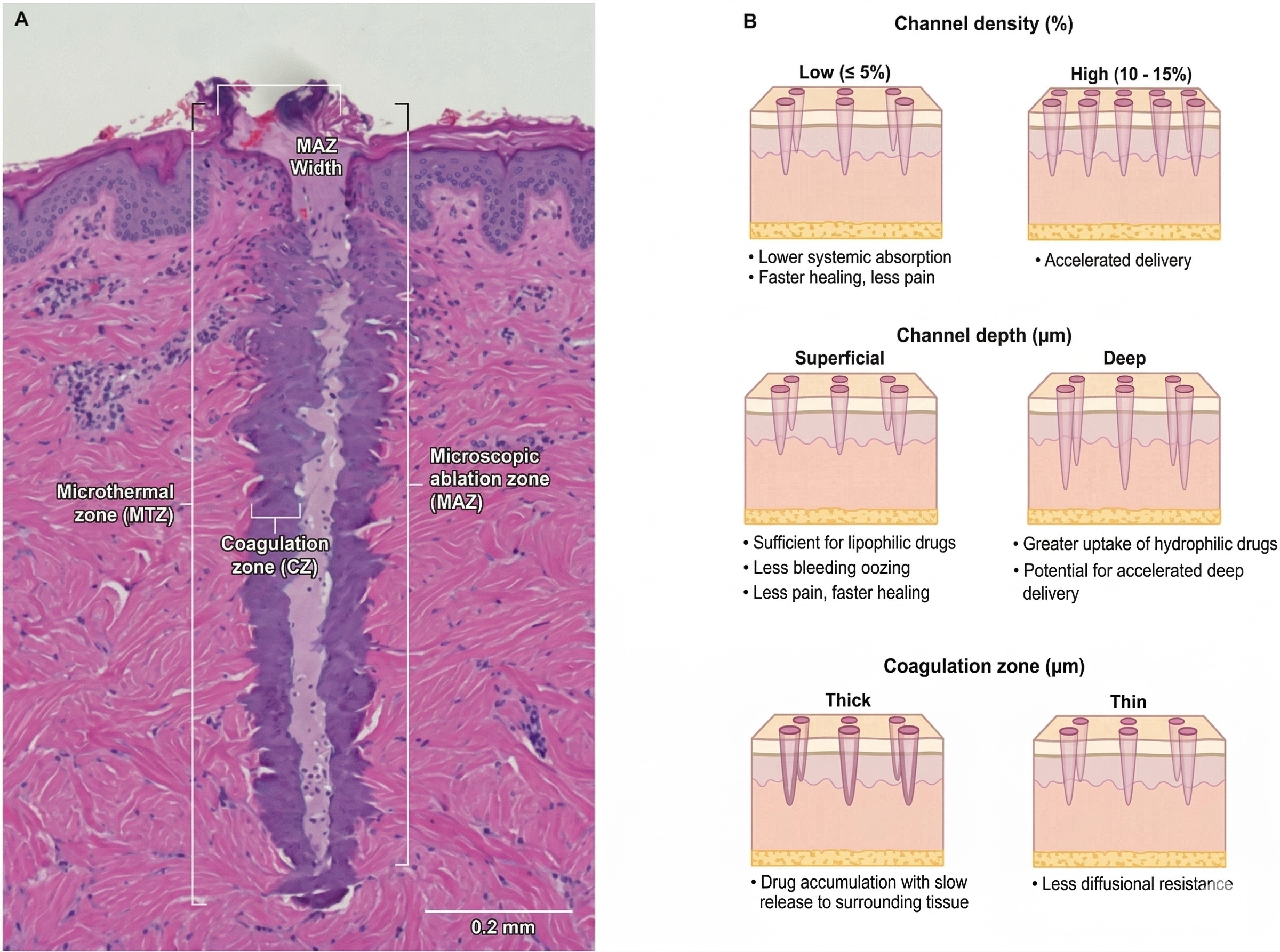 An image of Freelio's project ui