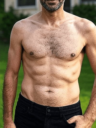 after-weight-loss