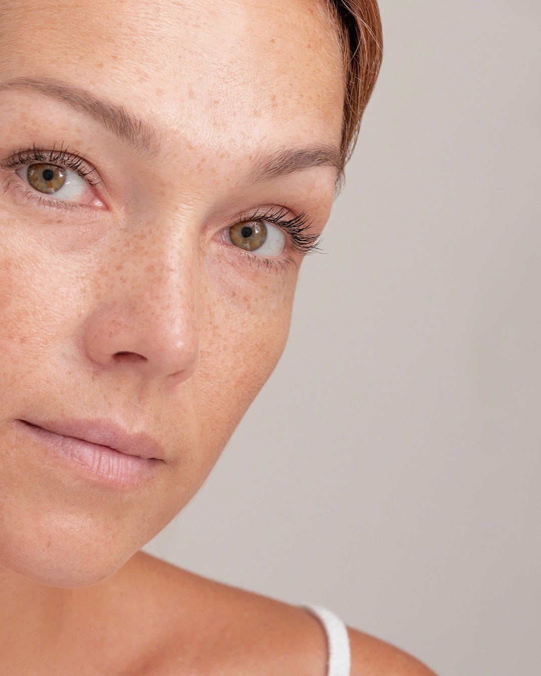 Medisinsk vurdering før rynkereduserende behandling hos Klinikk Kleppe Eksempel på område vurdert for rynkereduserende behandling Konsultasjon for behandling av linjer og rynker Individuelt tilpasset vurdering av hud og rynker