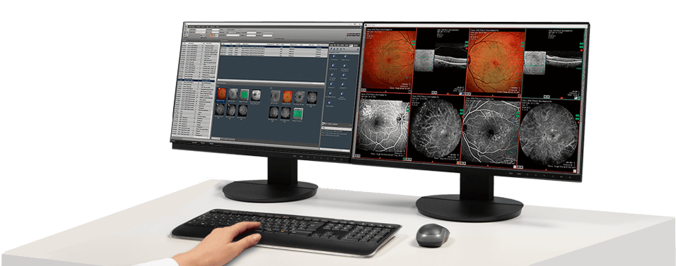 HEYEX 2 (Heidelberg Eye Explorer)  - VisReed