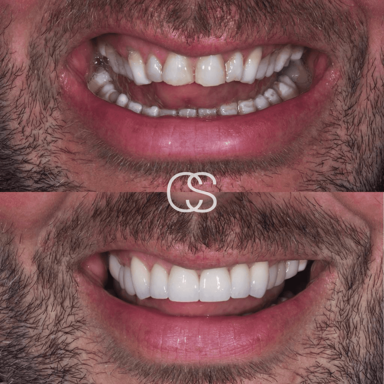 Before & After