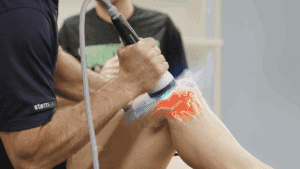 Focused Wave Therapy for Chronic Pain