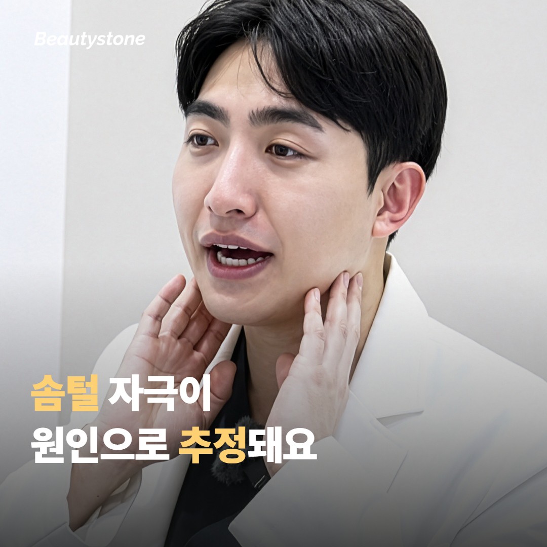 왜 이런 반응이 생기는 걸로 추정될까요