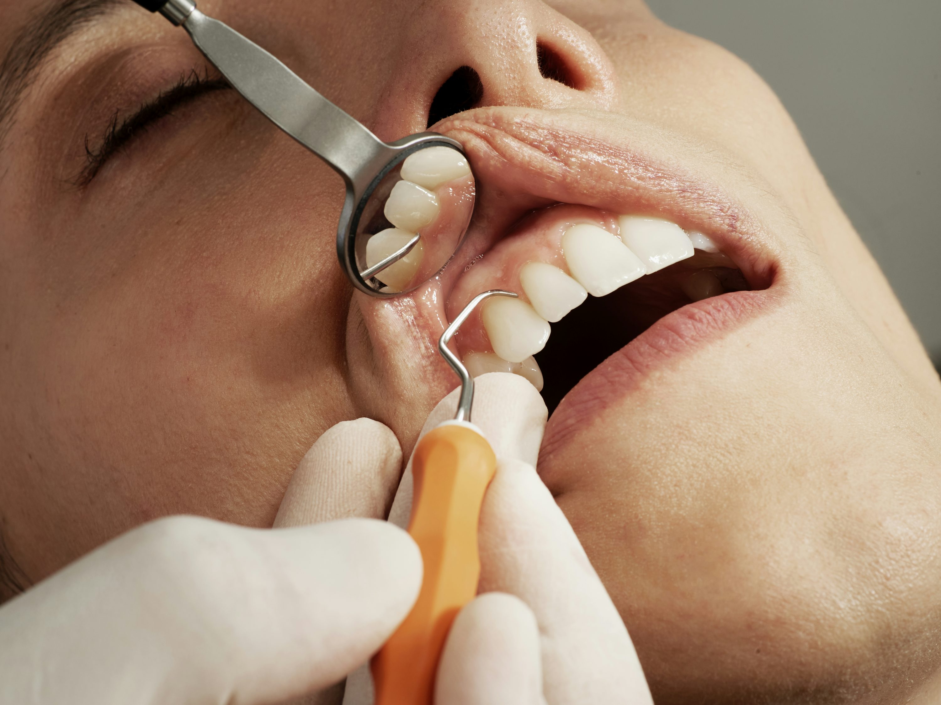 Dentist doing dental procedure