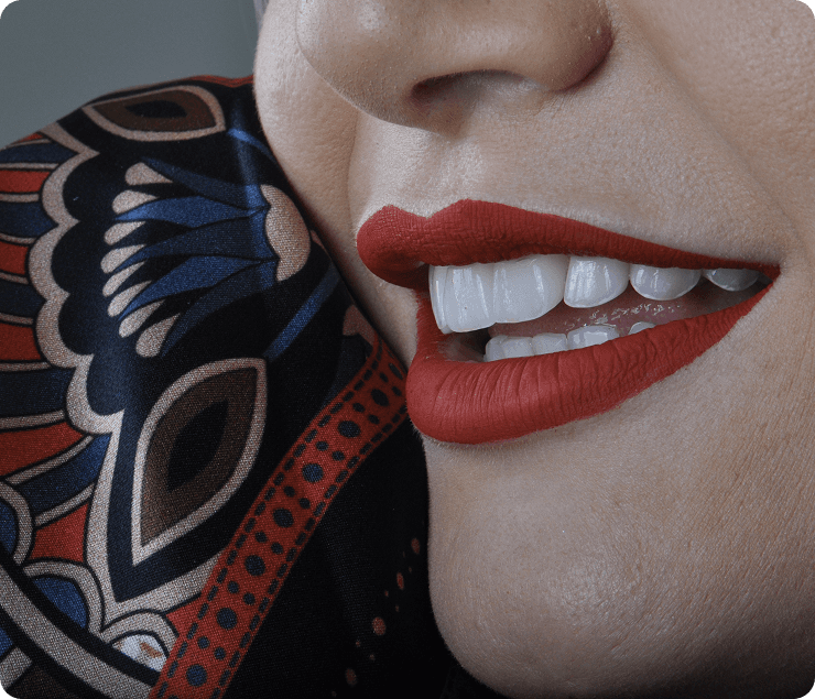 Imagem clínica do sorriso de paciente adulta, com identidade preservada