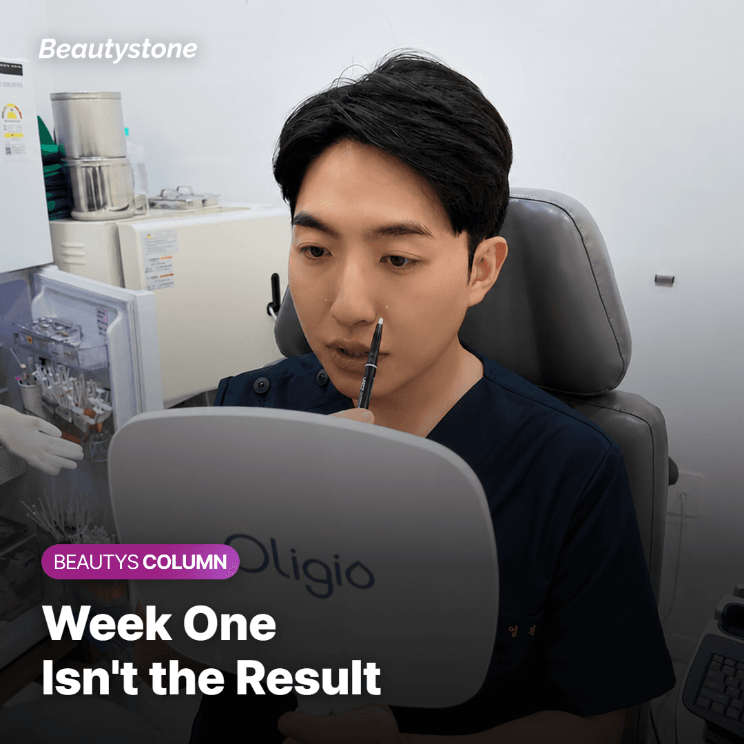 Calendar marking month 3 and month 6 checkpoints after a jawline RF treatment